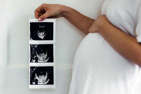 تعیین سن بارداری با سونوگرافی