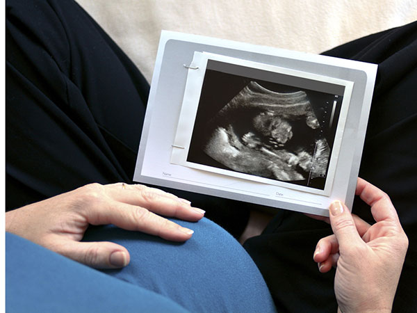 تعیین سن بارداری با سونوگرافی