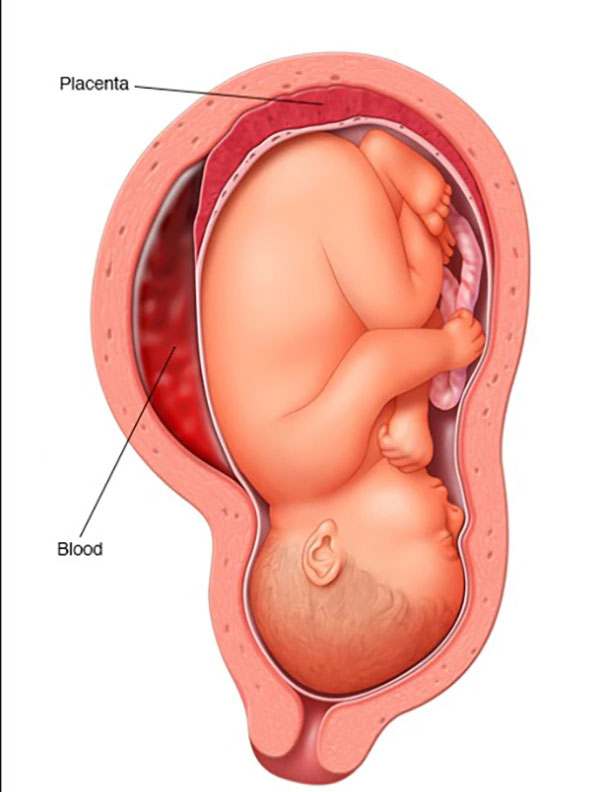 جفت و جنین در بارداری