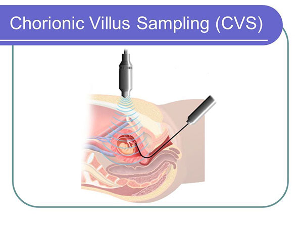 تست CVS