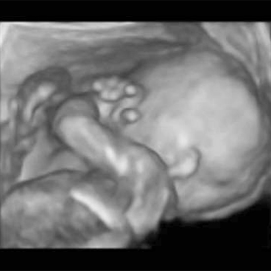 سونوگرافی سه ماهه دوم بارداری