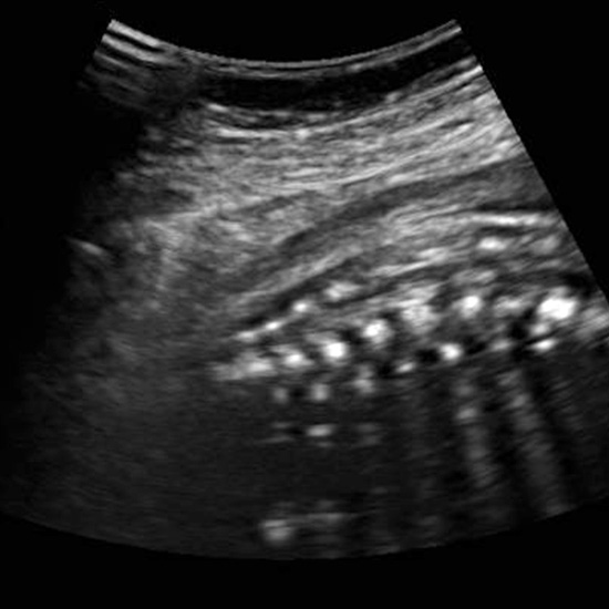سونوگرافی در سه ماهه سوم بارداری