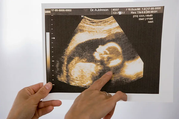 آیا سونوگرافی برای جنین بی خطر است؟