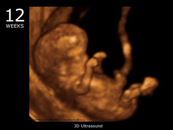 سونوگرافی هفته دوازدهم بارداری