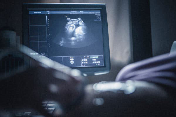 ضربان قلب جنین در سونوگرافی