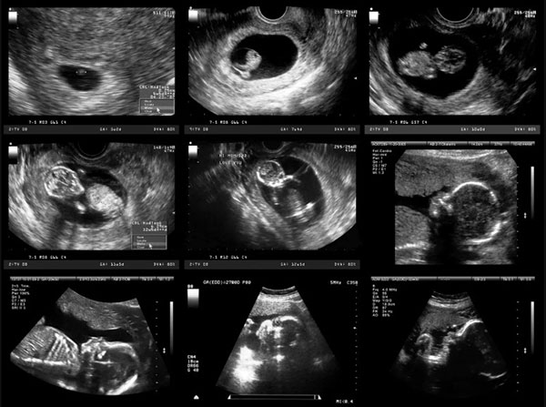 روند رشد جنین در سه ماهه دوم و سوم بارداری