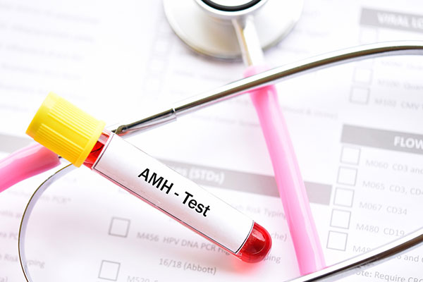 آزمایش خون سطح AMH