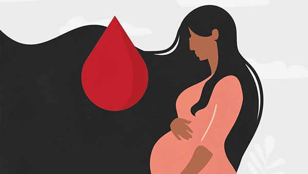 تفاوت سقط جنین در سه ماهه اول و دوم بارداری