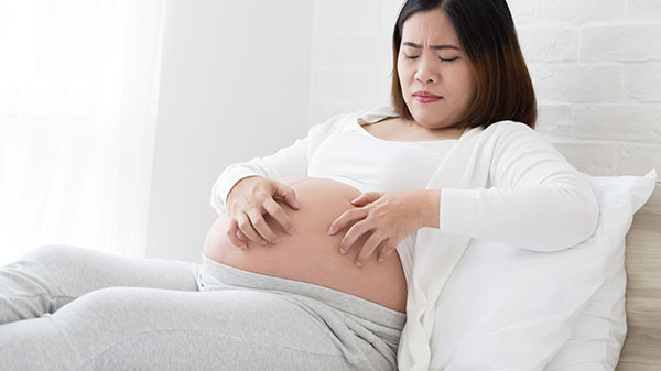 زونا در بارداری